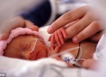 Bebê nascido de parto prematuro